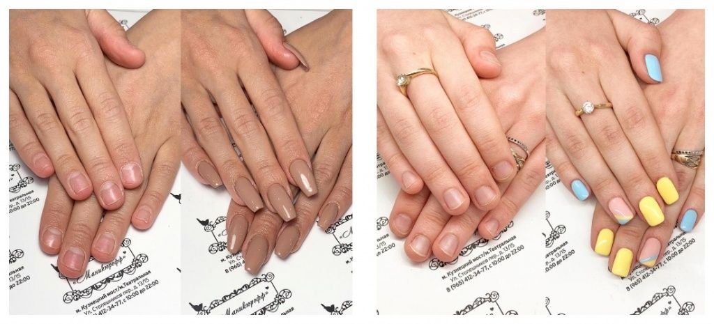 Наращивание ногтей (2 фото до и после)